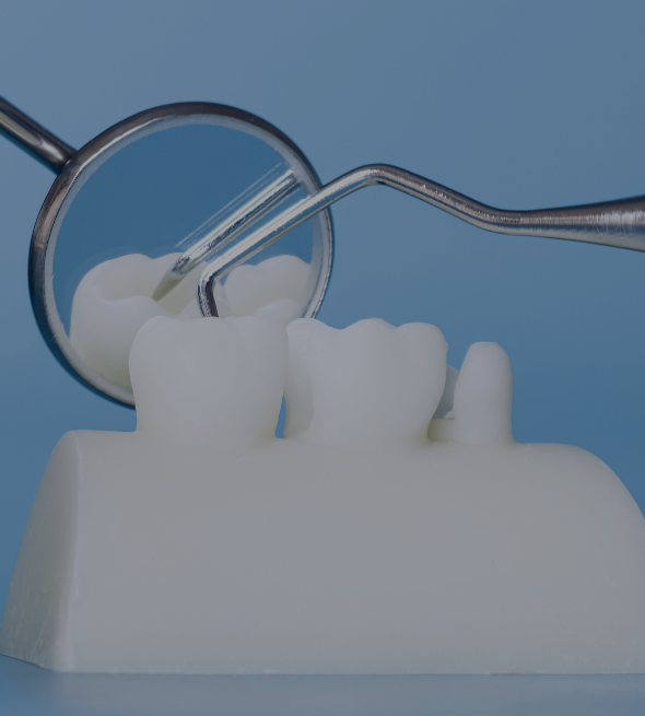 Long Lasting Dental Crowns and Bridges Near me in Lahore